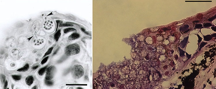 Fungus samples as seen under a microscope