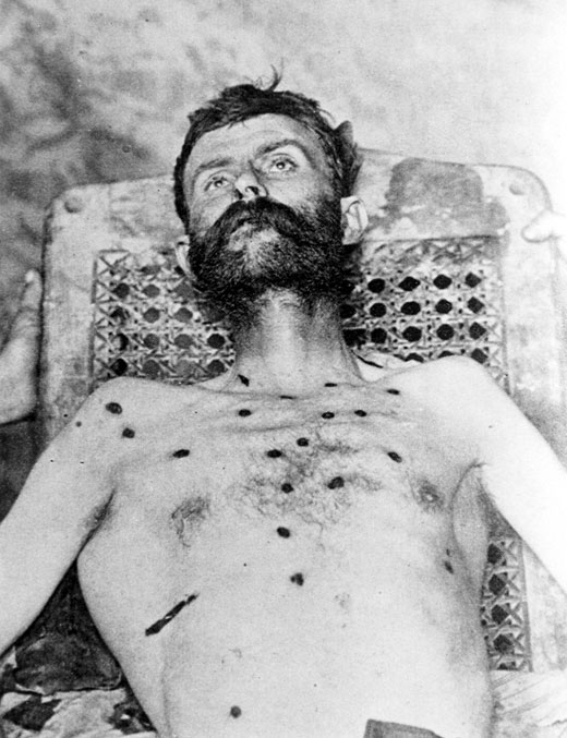 Corpse of white man with beard and multiple bullet wounds in bare chest being propped up in a chair
