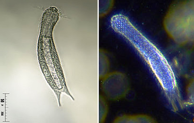 Worm like organisms under magnification