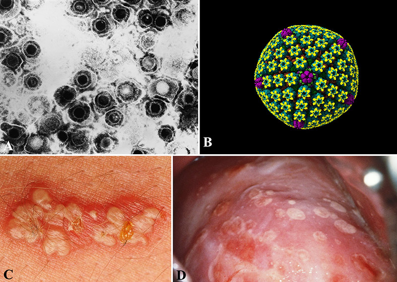 Herpes infection cells and skin with corresponding letters