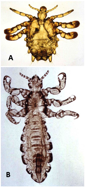 Types of lice with corresponding letters
