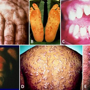 Infected human skin examples with corresponding letters