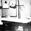 Black and white photo of white boy in tinted goggles lying on examination table below lights and medical device