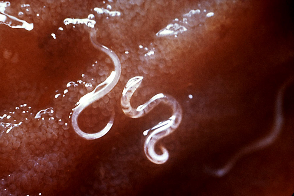 White worms attached to red viscous mucosa